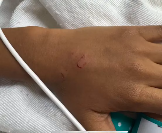 Madre dice que su hijo tiene miedo después de que un compañero lo apuñaló con un bolígrafo